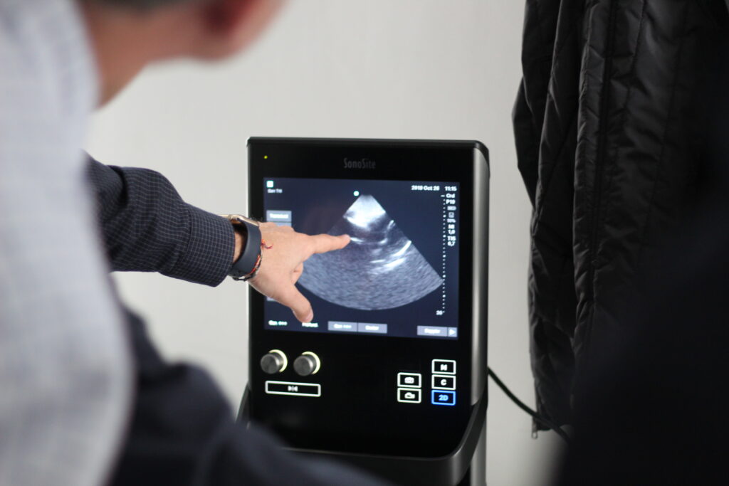 Curso de Ecografía Pulmonar en Málaga